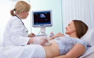 Доплер УЗИ при беременности: подготовка и особенности метода
