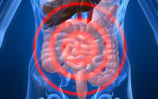 Ректальный плевок – характерный симптом серьезных патологий кишечника