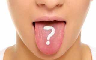 Чем опасен кандидоз полости рта: симптомы, причины, лечение у детей и взрослых